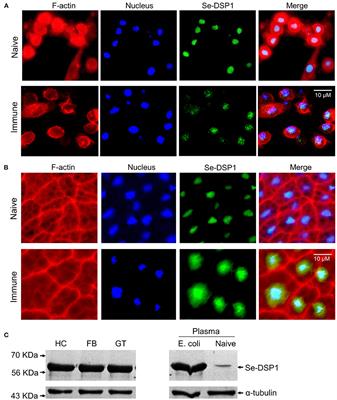 Salicylic Acid, a Plant Hormone, Suppresses Phytophagous Insect Immune Response by Interrupting HMG-Like DSP1